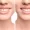 Diastema